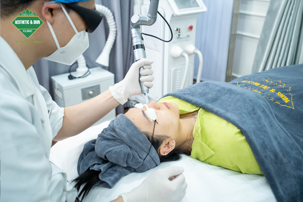 Bác sĩ tiến hành trị mụn bằng Laser Iris tuân theo uy trình chuẩn Y Khoa