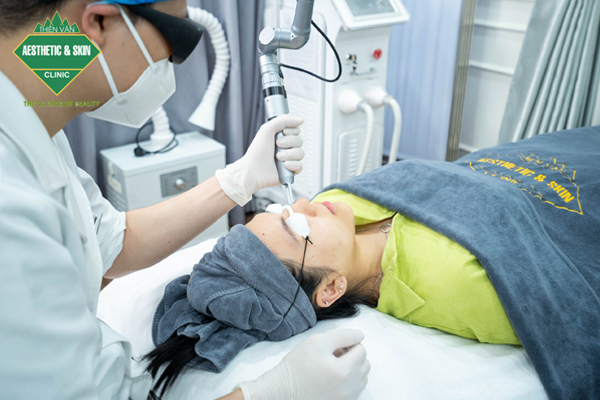 Công nghệ Laser Nd:YAG Spectra 1064