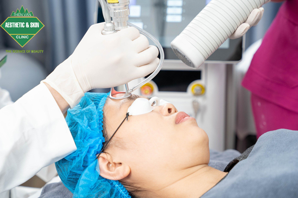 Laser CO2 tái tạo bề mặt