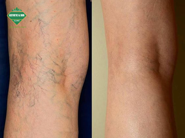 Khách hàng trước và sau điều trị