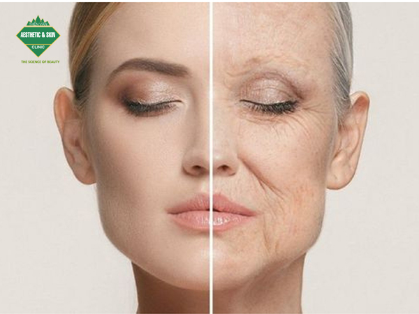 Tái tạo bề mặt trẻ hóa da bằng công nghệ laser co2