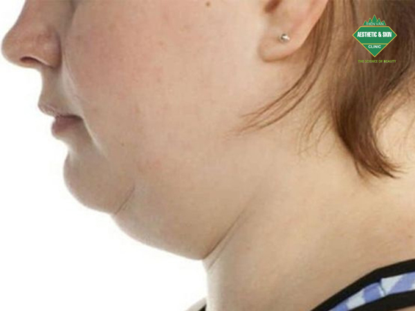 Đối tượng nên thon gọn nọng, cổ với Doulift sequential BV