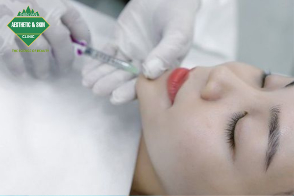 Khách hàng tiêm filler chất lượng cao